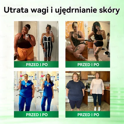 Oficjalny sklep| 👩‍⚕️𝗟𝘂𝘅𝗮𝗿𝗶𝘀𝗲® MORINGA Z BERBERYNA 10W1 Zaawansowany Nano-Mikroigłowy Plaster (Stosować raz na dobę, zauważalne efekty w ciągu 7 dni) ✅ Otyłość, cukrzyca, bezdech senny oraz schorzenia stawów.✨